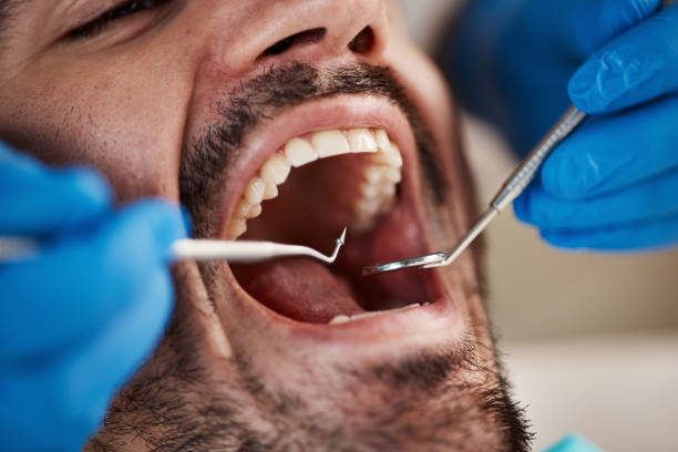 Best Emergency Dental Care for Broken or Chipped Teeth in St Peter, WI