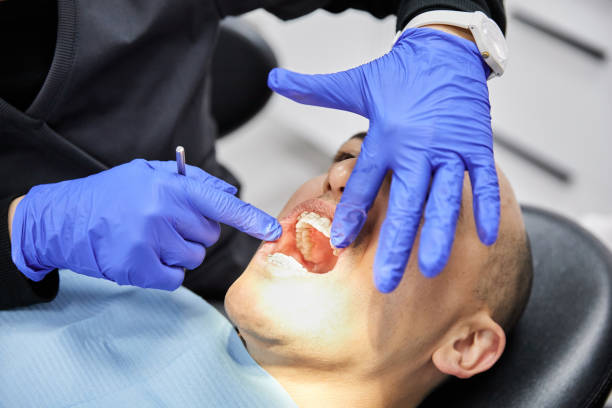 Best Emergency Root Canal Treatment in St Peter, WI